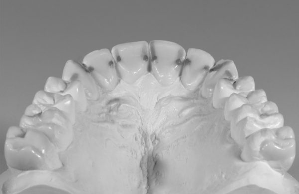 gnatologia e funzione 2