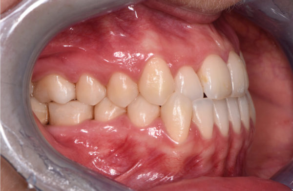 diagnosi-ortodontica-2