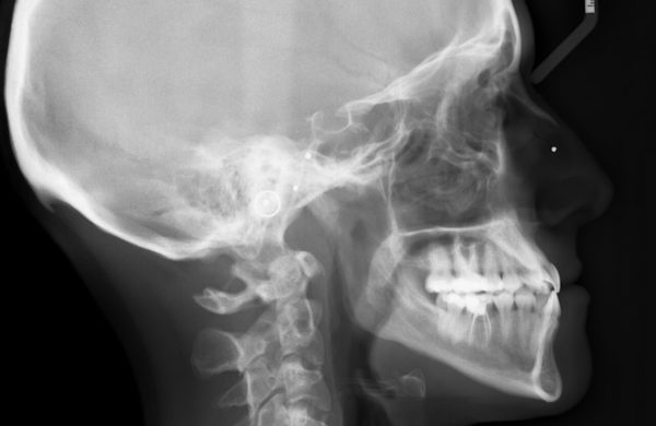 diagnosi-ortodontica-5
