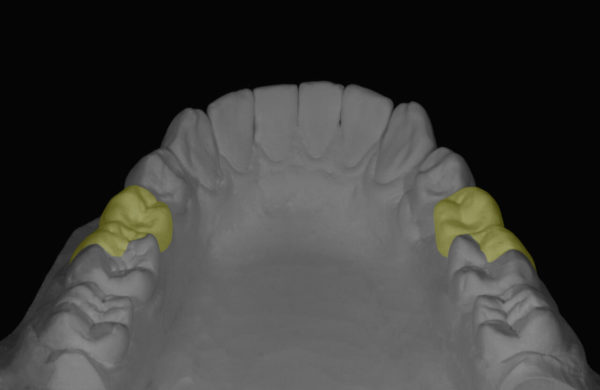 protesi-dentale2