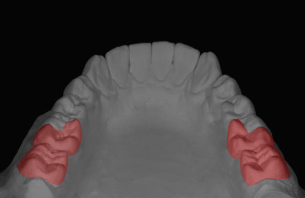protesi-dentale3